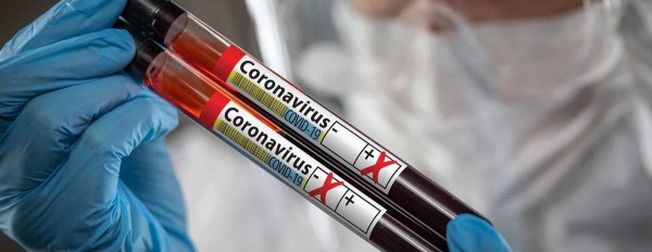 Страховщики выплатили около 840 млн руб. по страховкам от COVID-19 и заработали в 88 раз больше