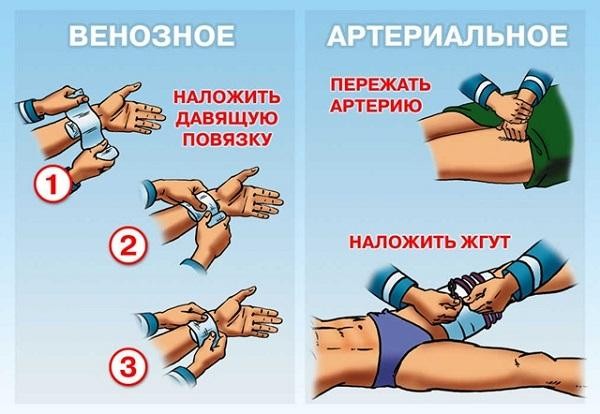 Автомобильная аптечка: состав, правила применения